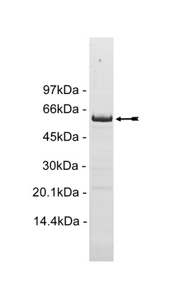 Eurofins DiscoverX PTPN22 (Phosphatase) Protein 10 &mu;g | Buy Online | Eurofins DiscoverX | Fisher Scientific